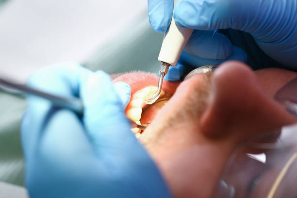 Tooth Infection Emergency Dentist in NJ