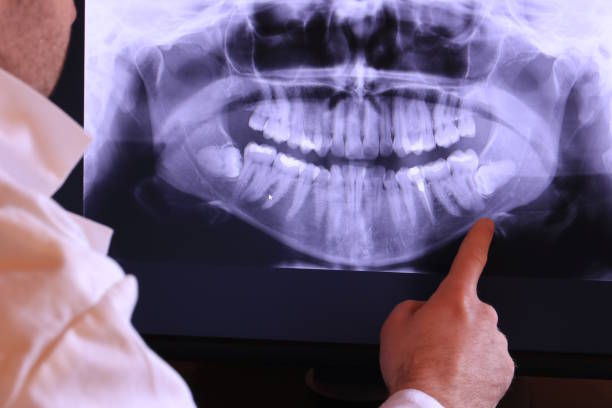 Best Knocked-Out Tooth Emergency  in Cologne, NJ