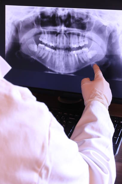 Best Emergency Dental Filling Replacement  in Cologne, NJ